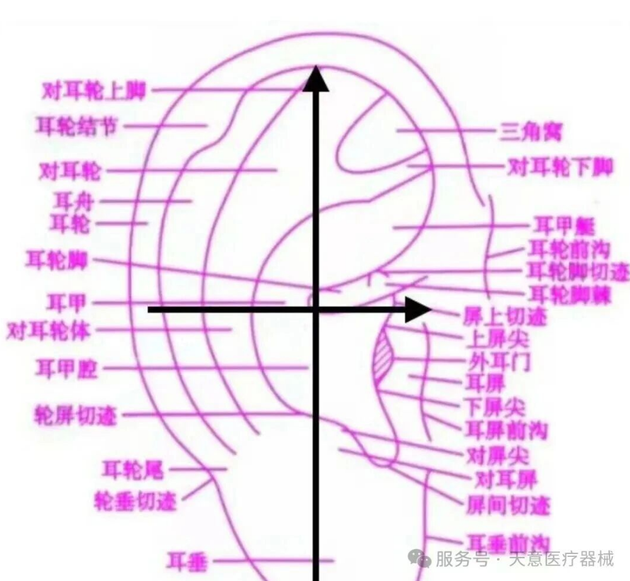 中医护理特色疗法—耳部全息刮痧